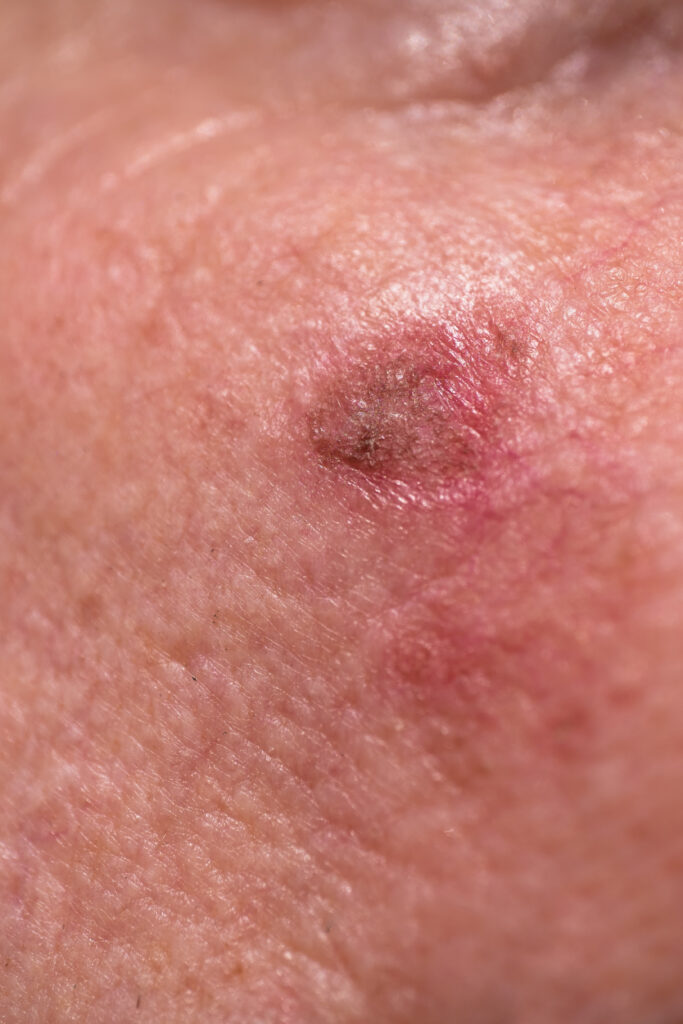 AdobeStock 426891198 scaled